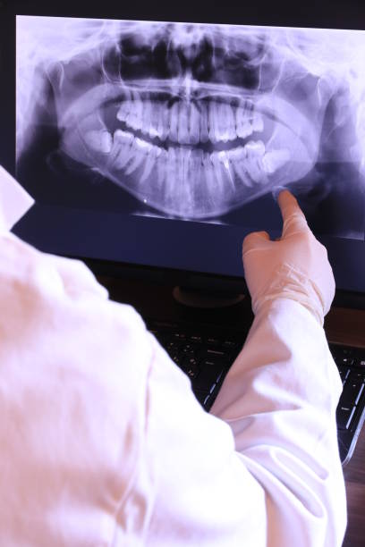 Best Emergency Root Canal Treatment in Reserve, LA