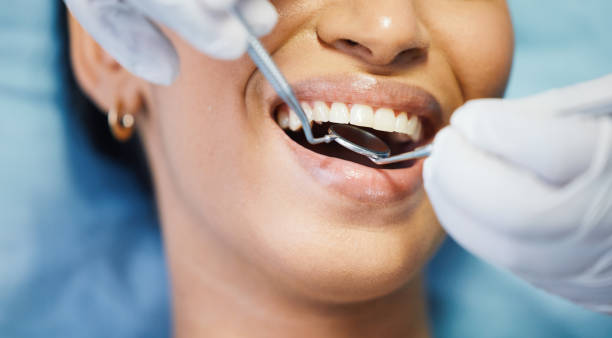 Best Emergency Denture Repair in Reserve, LA